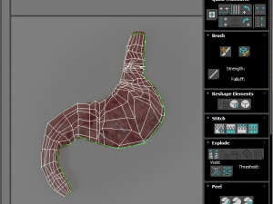 Stomach With Stomach Band 3D Model