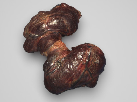 Thyroid Gland Model 3D