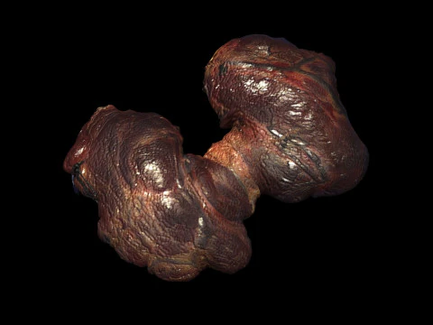 Kelenjar Tiroid Model 3D