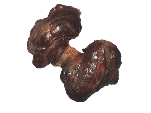Thyroid Gland Model 3D