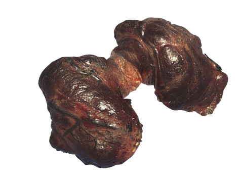 Thyroid Gland Model 3D