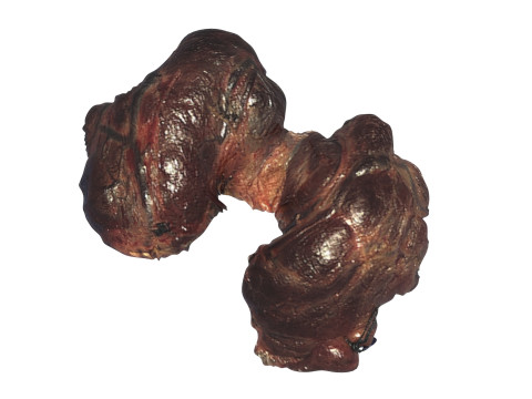 Thyroid Gland Model 3D