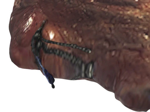Kelenjar Tiroid Model 3D