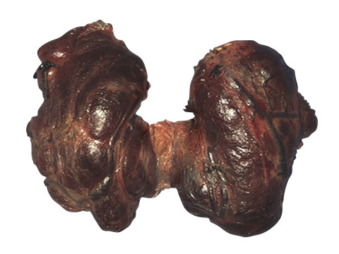 Thyroid Gland Model 3D