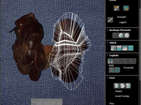 Kelenjar Tiroid Model 3D