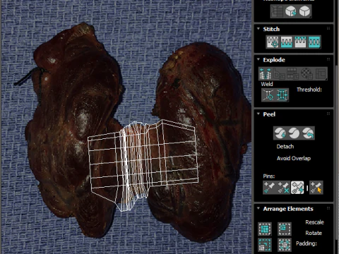Kelenjar Tiroid Model 3D