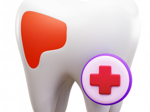 Dental Surgery 3D 모델
