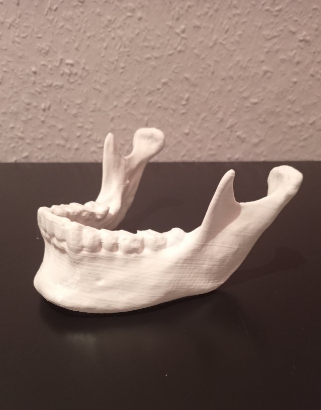 Human Jaw Anatomical Modelo de impresión 3D .c4d .max .obj .3ds .fbx .stl .blend 