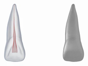 Dente incisivo centrale superiore sinistro umano con cavit&agrave; pulpare Modello 3D