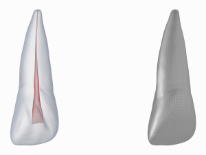 Human Upper Left Central Incisor Tooth With Pulp Cavity 3D Модель