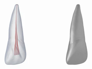 Dente incisivo centrale superiore sinistro umano con cavit&agrave; pulpare Modello 3D