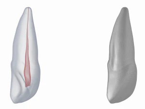 Dente incisivo centrale superiore sinistro umano con cavit&agrave; pulpare Modello 3D