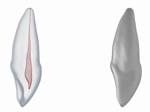 Dente incisivo centrale superiore sinistro umano con cavit&agrave; pulpare Modello 3D