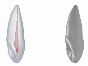 Dente incisivo centrale superiore sinistro umano con cavit&agrave; pulpare Modello 3D