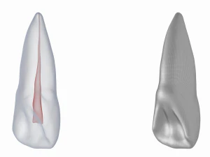 Dente incisivo centrale superiore sinistro umano con cavit&agrave; pulpare Modello 3D