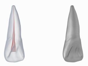 Human Upper Left Central Incisor Tooth With Pulp Cavity 3D Модель