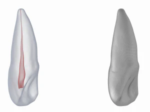 Dente incisivo centrale superiore sinistro umano con cavit&agrave; pulpare Modello 3D