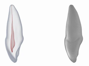 Dente incisivo centrale superiore sinistro umano con cavit&agrave; pulpare Modello 3D