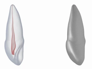 Dente incisivo centrale superiore sinistro umano con cavit&agrave; pulpare Modello 3D