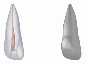 Dente incisivo centrale superiore sinistro umano con cavit&agrave; pulpare Modello 3D
