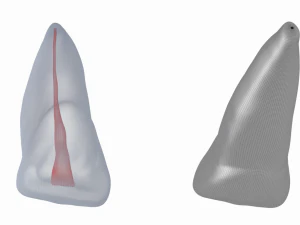 Dente incisivo centrale superiore sinistro umano con cavit&agrave; pulpare Modello 3D