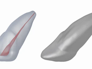 Dente incisivo centrale superiore sinistro umano con cavit&agrave; pulpare Modello 3D