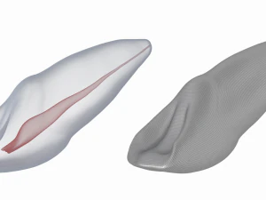 Dente incisivo centrale superiore sinistro umano con cavit&agrave; pulpare Modello 3D