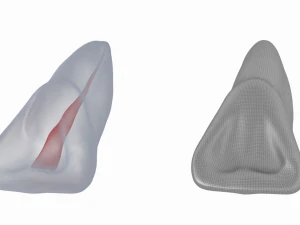 Dente incisivo centrale superiore sinistro umano con cavit&agrave; pulpare Modello 3D