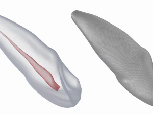 Dente incisivo centrale superiore sinistro umano con cavit&agrave; pulpare Modello 3D