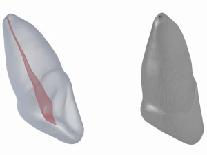 Dente incisivo centrale superiore sinistro umano con cavit&agrave; pulpare Modello 3D