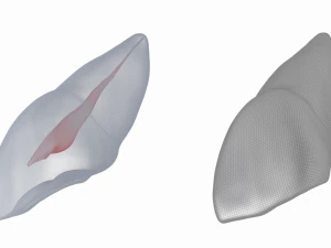 Dente incisivo centrale superiore sinistro umano con cavit&agrave; pulpare Modello 3D