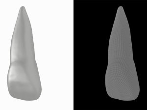 Human Upper Left Central Incisor Tooth 3D Model