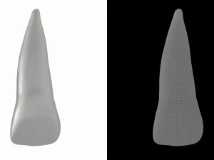 Human Upper Left Central Incisor Tooth 3D Model