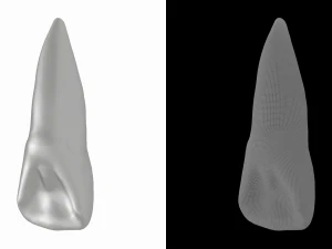 Human Upper Left Central Incisor Tooth 3D Model