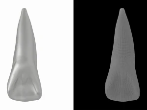 Human Upper Left Central Incisor Tooth 3D Model