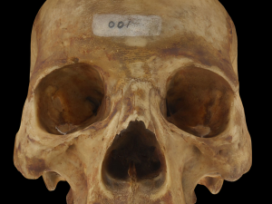 Edent Adult Human Skull Modello 3D