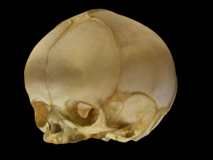 Tengkorak Manusia Neonatus Model 3D