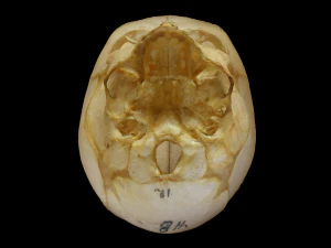 Neonate Human Skull 3D Model