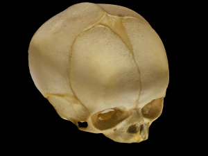 Neonate Human Skull 3D Model