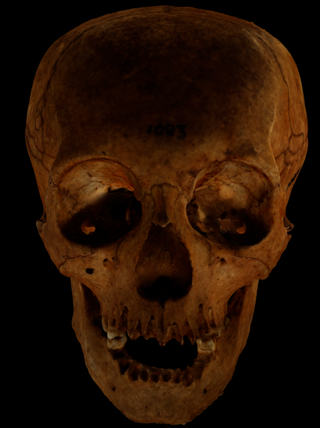 Human Skull with deformation 3D Модель .c4d .max .obj .3ds .fbx .stl .blend 