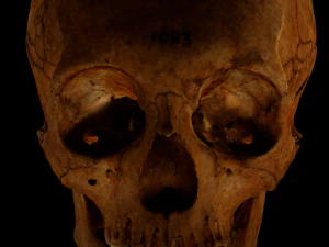 Tengkorak Manusia dengan deformasi Model 3D