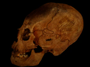 Human Skull with deformation 3D Model