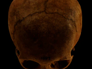 Human Skull with deformation 3D Model