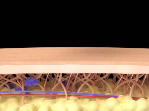 Medical motion graphic Skin Anti-Aging Treatment 3D Model