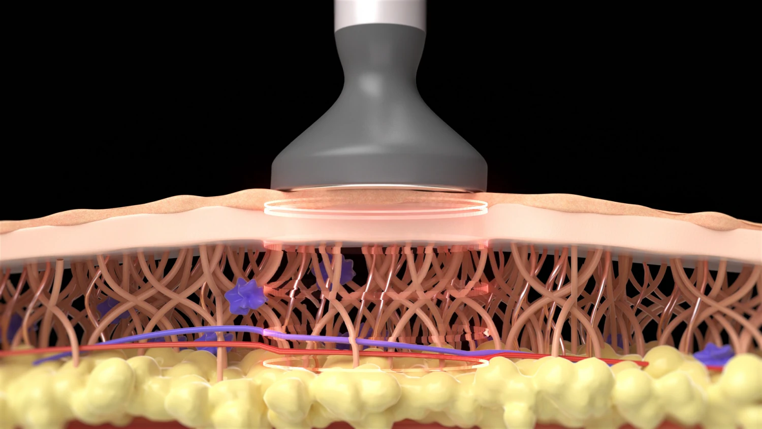 Medical motion graphic Skin Anti-Aging Treatment 3D Model .c4d .max .obj .3ds .fbx .stl .blend 