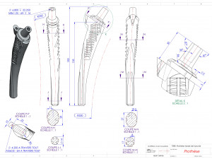 PROSTHESIS Model 3D