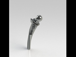PROSTHESIS Model 3D
