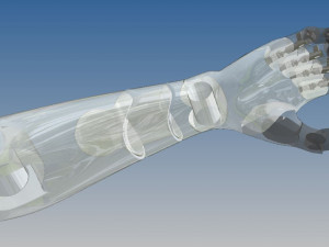 Bionic-hand 3D-Modell