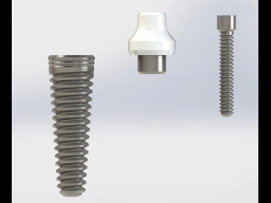Dental implant 3D Model