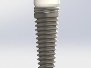 Dental implant 3D 模型